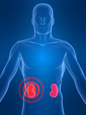 Acute Kidney Failure Can Also Be Treated